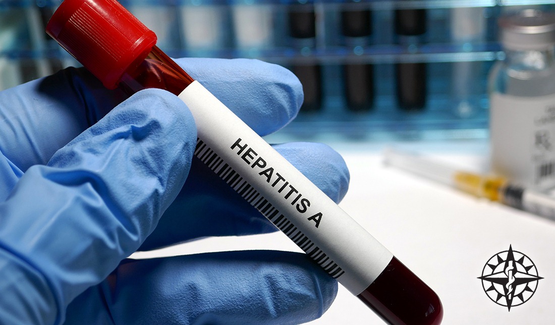 Hepatitis A in Tampa Bay