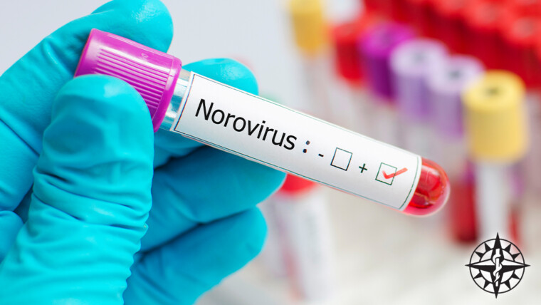 Norovirus – The Unwelcome Invader: Causes, Symptoms, and Treatment Options