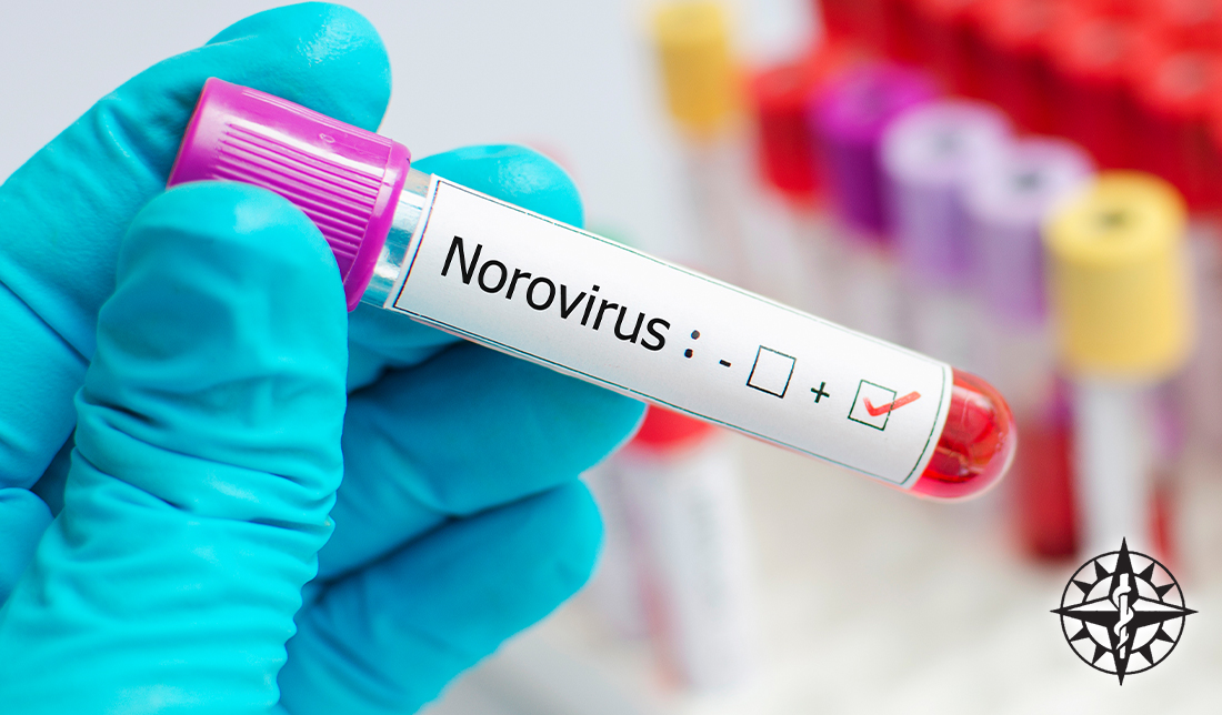 Norovirus – The Unwelcome Invader: Causes, Symptoms, and Treatment Options